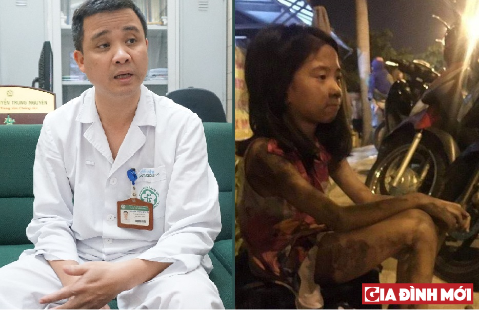 ThS.BS Nguyễn Trung Nguyên, Phụ trách Trung tâm Chống độc, Bệnh viện Bạch Mai (ảnh trái) và một em nhỏ nạn nhân của đám cháy chung cư Carina (ảnh phải)