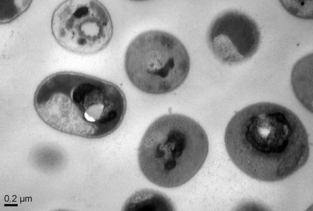 Hình ảnh các phân tử polime tấn công siêu vi khuẩn và ngăn chặn chúng sinh sản - Ảnh: IBM reserch
