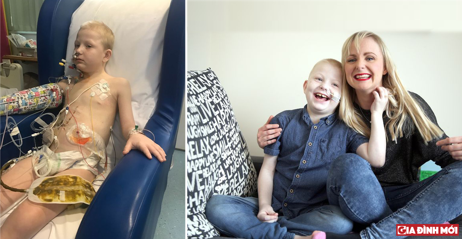 Ca cấy ghép kéo dài tới 10 giờ tại bệnh viện Birmingham Children đã cứu sống cậu bé Jay Crouch