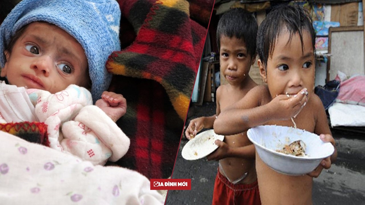 20 triệu trẻ em dưới 5 tuổi suy dinh dưỡng là vấn đề nhức nhối trên toàn cầu