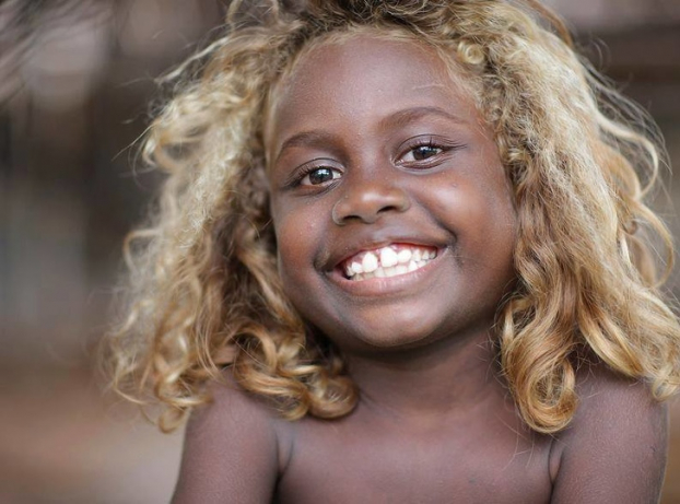   Trên các đảo nhỏ thuộc quần đảo Solomon nằm giữa Thái Bình Dương, có những người bản địa thuộc chủng tộc Melanesia. Họ có làn da đen và mái tóc vàng bẩm sinh  