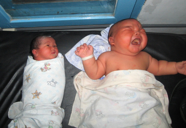   Một bé sơ sinh nặng 3,6 kg và một bé sơ sinh nặng 10,4 kg  