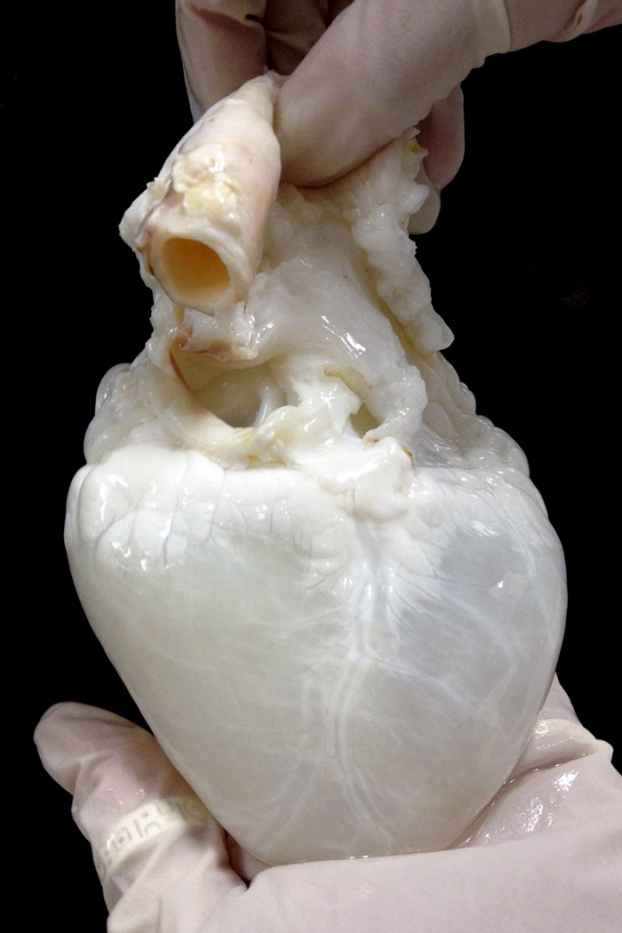   'Trái tim ma' một loại giá thể cấu trúc – được các nhà khoa học sử dụng một dung dịch tẩy rửa đơn giản để tạo ra. Khi họ ngâm quả tim lợn trong dung dịch đó và có thể sau đó là một số bước xử lý nữa, họ đã có một giá thể (scaffolding) protein thuần khiết mất đi toàn bộ tế bào sống (decellularized – khử tế bào). Giá thể đó có thể được tùy biến và được dùng để phát triển thành trái tim dành cho các bệnh nhân nhất định – sử dụng các tế bào gốc tủy xương.  