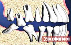Sức khỏe răng miệng ảnh hưởng tới hôn nhân gia đình như thế nào? 3