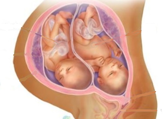   Phụ nữ mang thai đôi tiềm ẩn nhiều rủi ro về sức khỏe cho cả mẹ và bé. Ảnh minh họa  