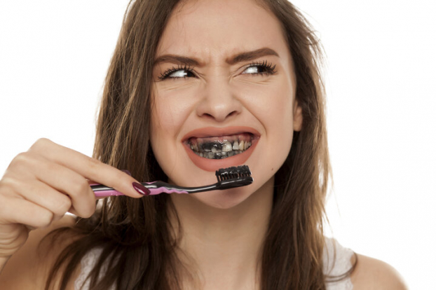 Kem đánh răng than hoạt tính: Không có tác dụng làm trắng như lời đồn mà còn gây sâu răng 2