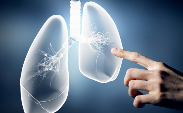   Phẫu thuật nội soi lồng ngực cắt thùy phổi lá một trong những phương pháp được áp dụng để điều trị các bệnh lý về phổi. Ảnh minh họa  