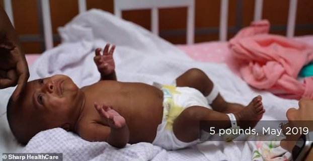 Cứu sống bé sơ sinh nhỏ nhất thế giới, sinh non 3 tháng, khi chào đời chỉ nặng 245 gam 2