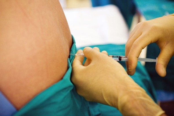   Bộ Y tế chỉ đạo cần chấn chỉnh phương pháp gây tê tủy sống trong mổ lấy thai.  