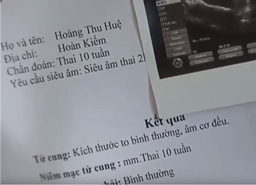   Đầu phim, Huệ để lộ giấy khám thai ghi tên là Hoàng Thu Huệ, nhưng trong tập 39 bác sĩ lại đọc tên nhân vật là Nguyễn Thu Huệ  