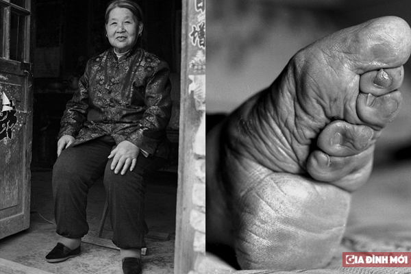   Bà Tô Dung với chân trái biến dạng - Mọi người kể lại rằng bà Tô từng là người phụ nữ đẹp nhất làng  