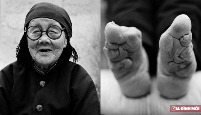   Bà Dương Tình với đôi chân bị bó từ năm 1928 bởi người bà của mình  