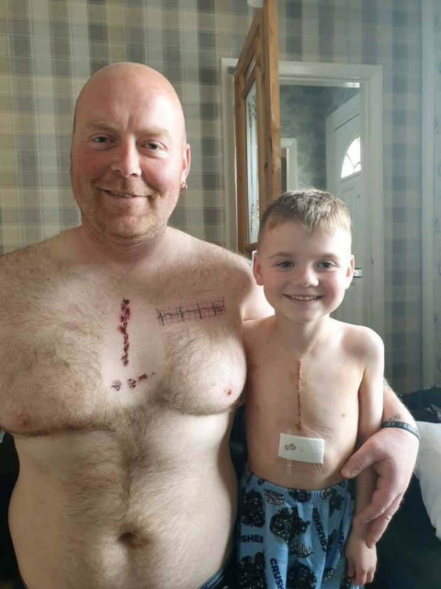 Ông bố xăm hình trên ngực giống vết sẹo phẫu thuật tim của con trai 2