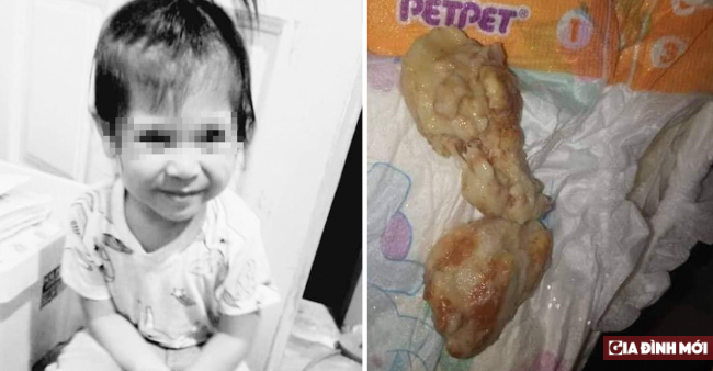 Bé gái 2 tuổi tử vong vì hóc mẩu bánh mì ở nhà người trông trẻ 0