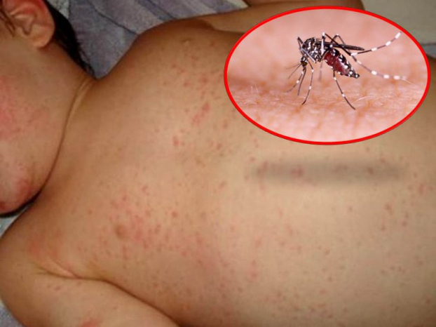   Cần tiến hành tiêu diệt muỗi để phòng ngừa bệnh sốt xuất huyết. Ảnh minh họa  