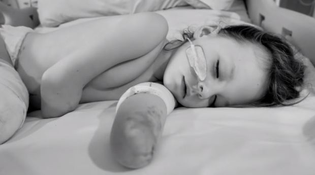 Bé gái 6 tuổi mất chân tay vì bị chẩn đoán nhầm nhiễm trùng máu với cúm 3