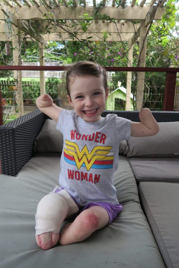 Bé gái 6 tuổi mất chân tay vì bị chẩn đoán nhầm nhiễm trùng máu với cúm 0