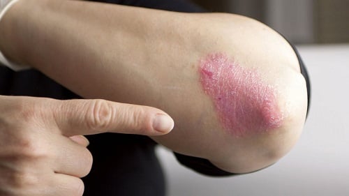 Tác dụng thần kỳ với sức khỏe của muối ăn không phải ai cũng biết 1