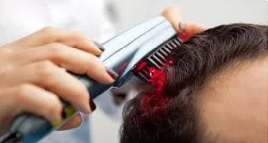 Nghiên cứu mới: Ăn kim chi có thể giúp tóc mọc nhanh, chữa hói đầu? 4