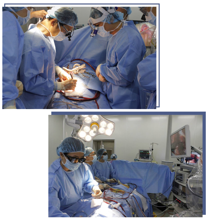   Đến nay, Trung tâm Tim mạch BV E là cơ sở phẫu thuật duy nhất trong cả nước thực hiện thường quy phẫu thuật mổ tim nội soi bằng hệ thống 3D  