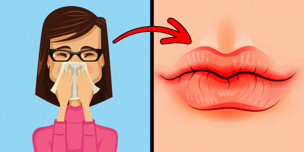 8 dấu hiệu đôi môi cảnh báo sức khỏe của bạn đang gặp vấn đề 2