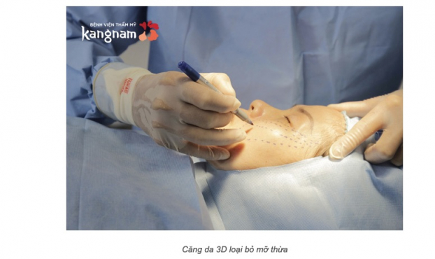 Thẩm mỹ viện Kangnam: Dịch vụ căng da mặt tiến hành thế nào? 1