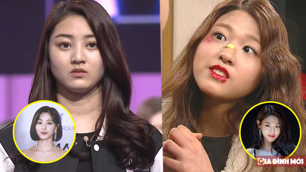   Nhan sắc sao nữ Kpop trước và sau khi giảm cân: Jihyo, Seolhyun lột xác ngoạn mục  