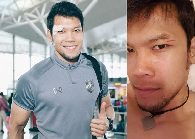   Kawin - Thủ môn Thái Lan đăng trên trang cá nhân, với một vết cắt nhỏ ở mắt phải, không cần khâu  