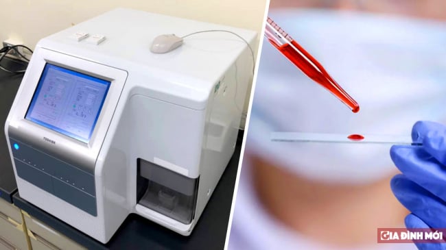   Toshiba tạo ra thiết bị phát hiện 13 loại ung thư chỉ với 1 giọt máu  