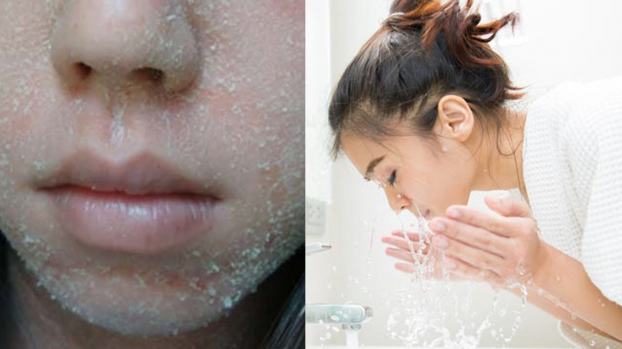   Rửa mặt bằng sữa rửa mặt và dưỡng ẩm ngay sau khi rửa mặt là các bước chăm sóc da quan trọng trong mùa đông để da không khô sần, xấu xí  