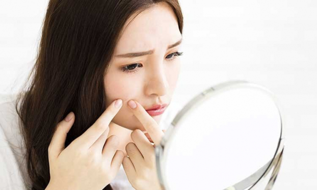 10 thói quen chăm sóc da khiến mặt bạn bị mụn nghiêm trọng hơn 4