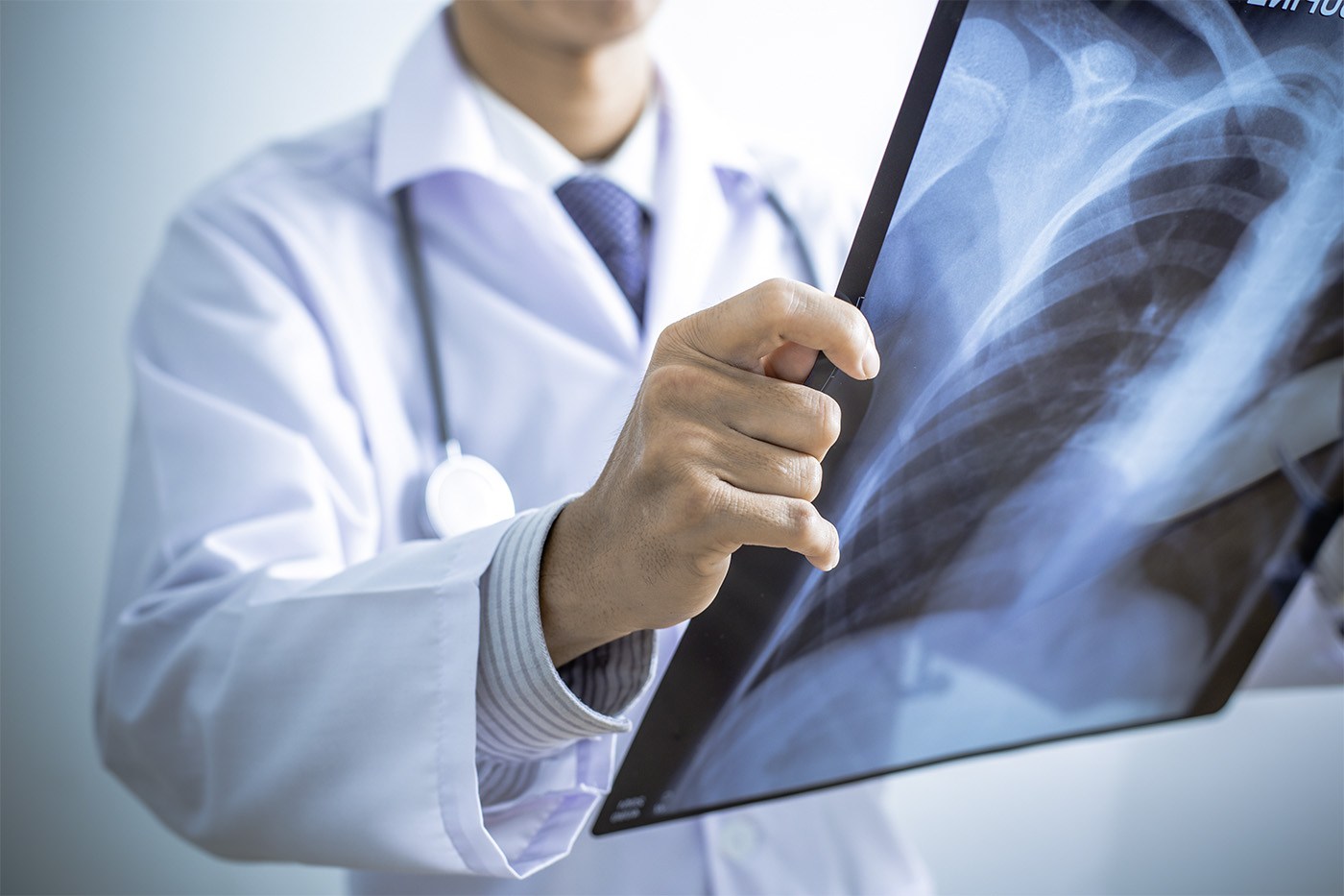   Khi bị viêm phổi, bệnh nhân có thể cảm thấy đau lưng khi thở  
