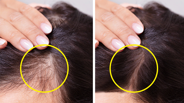 9 cách giúp mái tóc mỏng trở nên dày và bồng bềnh 7