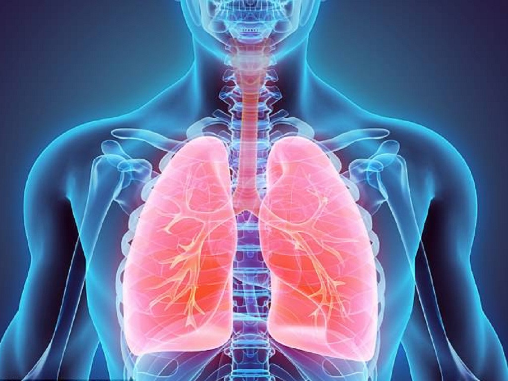   Viêm phổi là một biến chứng nặng nề của bệnh cúm (Ảnh minh họa)  