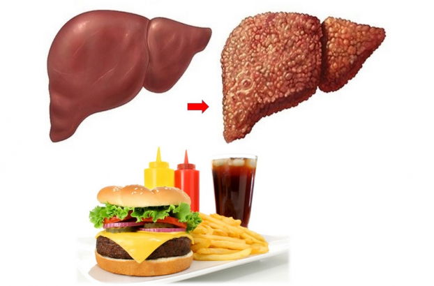   Các chất kích thích, đồ ăn nhanh, đồ cay nóng đều là những thực phẩm gây hại cho gan  