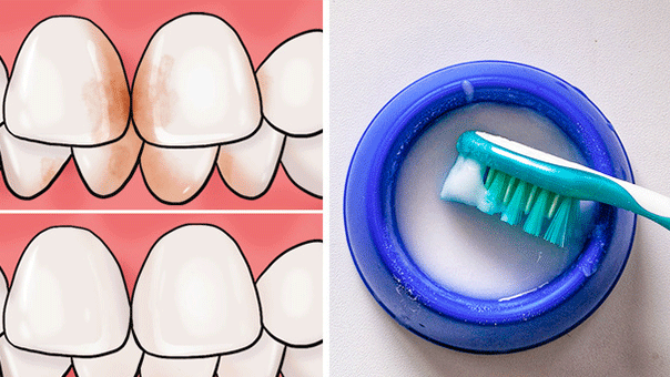 7 mẹo giúp loại bỏ mảng bám răng không cần đến nha sĩ 1