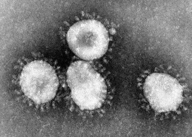   Coronaviruses (CoV) là một họ các virus có thể gây ra các bệnh lý của đường hô hấp trên và đường tiêu hóa ở người  