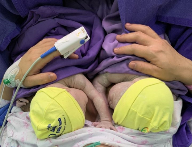   2 em bé đang được da kề da với mẹ sau khi sinh  