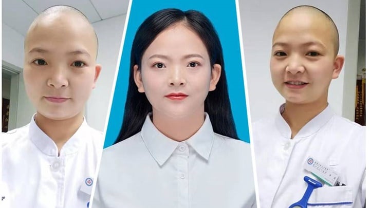   1 y tá ở Vũ Hán cạo trọc đầu để hỗ trợ công tác chống virus Corona  