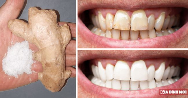   7 cách tự nhiên để làm cho răng trắng hơn tại nhà  