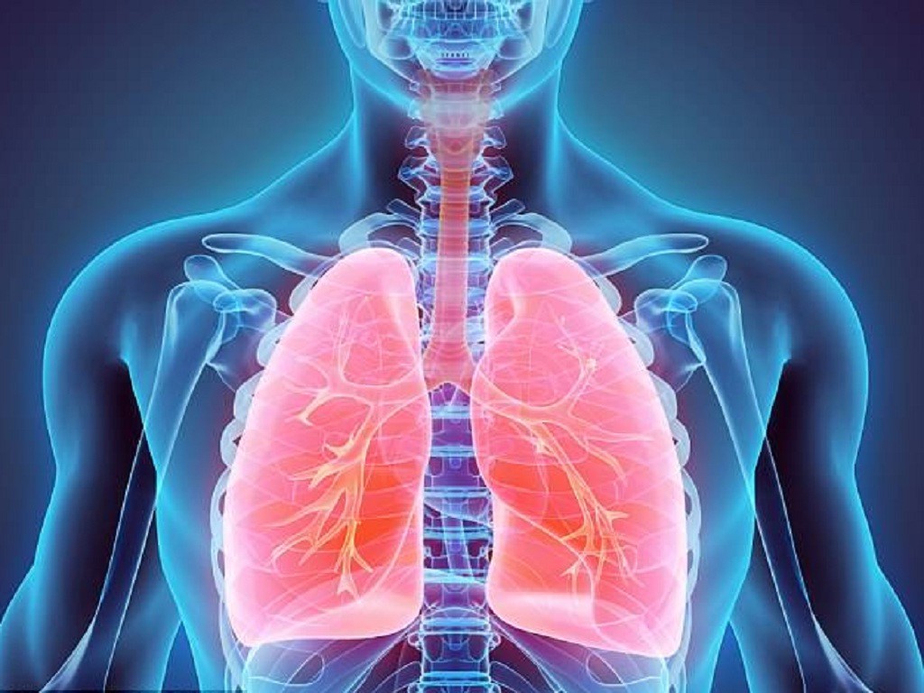   Viêm phổi là một trong những biến chứng của virus Corona  