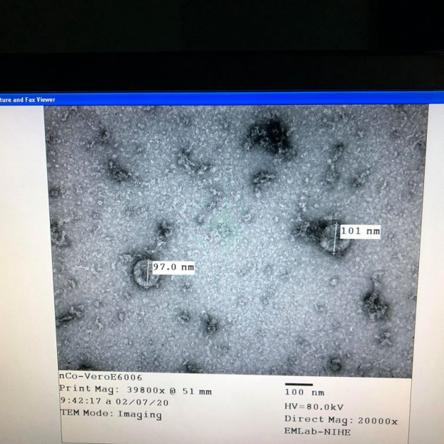   Viện vệ sinh dịch tễ trung ương đã nuôi cấy và phân lập thành công virus Corona.  