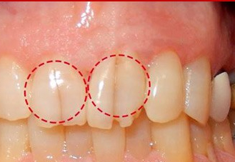 6 dấu hiệu của răng miệng cảnh báo sức khỏe chắc chắn đang có vấn đề 3