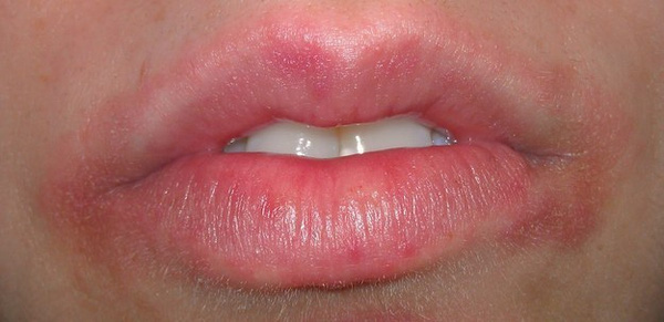 6 dấu hiệu của răng miệng cảnh báo sức khỏe chắc chắn đang có vấn đề 5