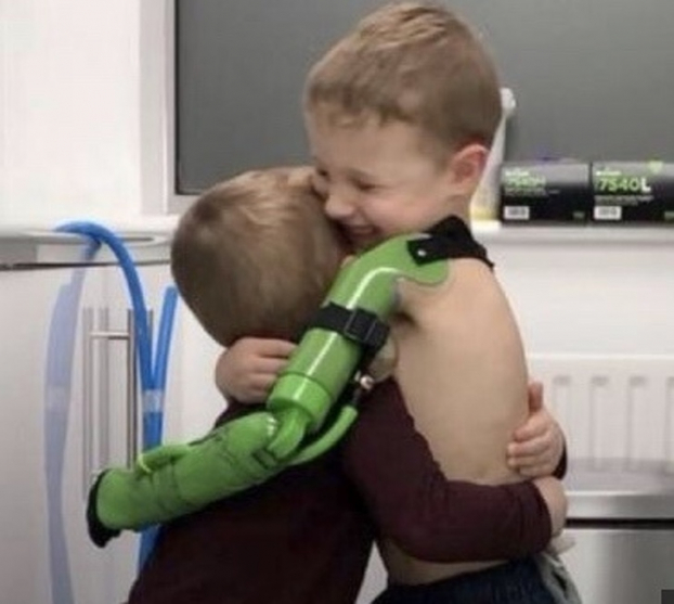   Cậu bé Jacob cuối cùng cũng có thể ôm em trai  