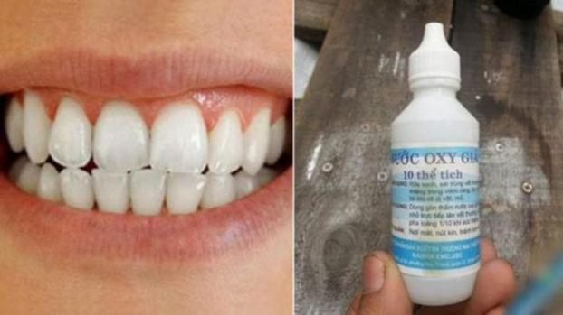 8 cách trị đau răng bằng những bài thuốc có sẵn trong nhà vô cùng hiệu quả 1