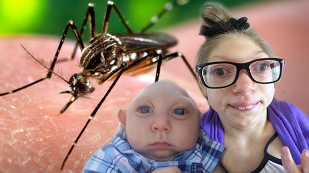   Virus Zika có thể gây đầu nhỏ ở trẻ  