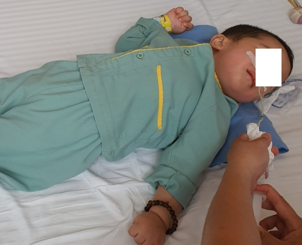   Hóc thạch trong trà sữa trân châu, bé trai 21 tháng tuổi bị bại não. Ảnh GS Thanh Liêm chia sẻ  