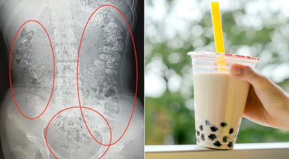   Trà sữa chứa rất nhiều đường nếu uống nhiều rất nguy hiểm cho sức khỏe  
