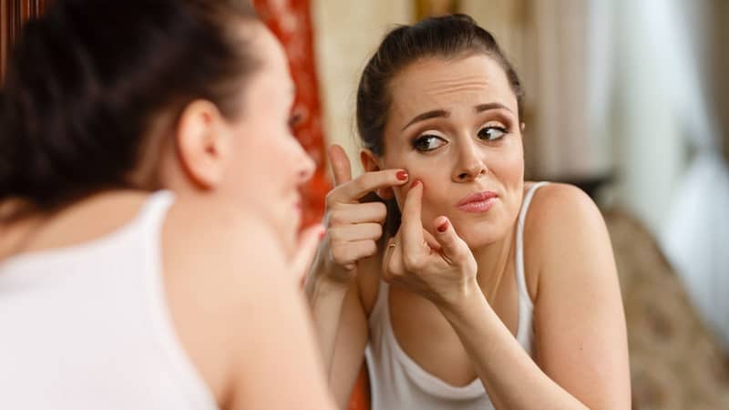   Nặn mụn là một trong những thói quen bạn cần tránh để có làn da đẹp hơn  
